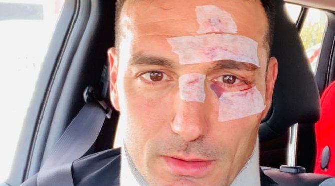 F: Scaloni (Twitter) F: Scaloni (Twitter)