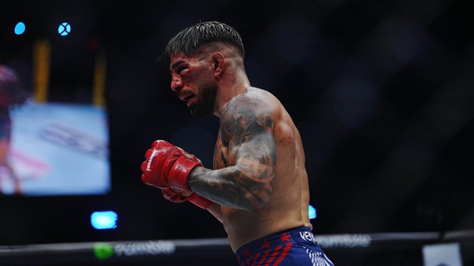 La UFC informa que Ilia Topuria está en el hospital y podría tener