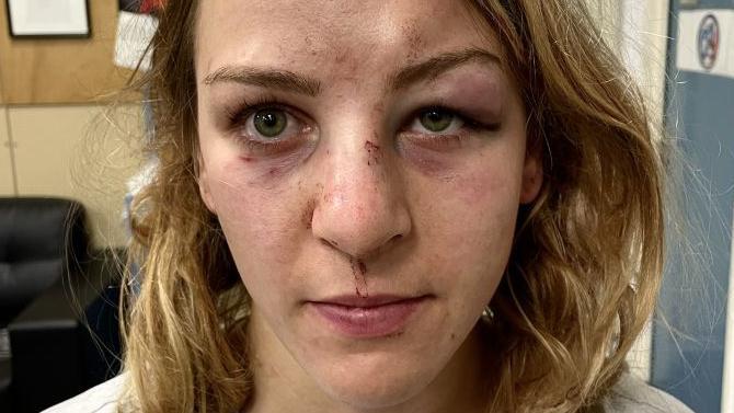 F: @MargauxPinot2 F: @MargauxPinot2